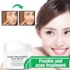 Anti Stains Acne Treatment Cream Scar Blackhead Face Cream Shrink Pores Whitening Skin Care Face Cream Korean Cosmetics - 15G