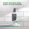Dove Men+Care Advanced Care Acne Clear Cleanser, 16.9 oz - Dove